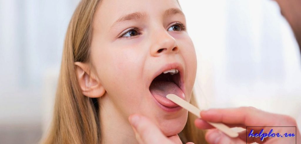 белый налет на горле