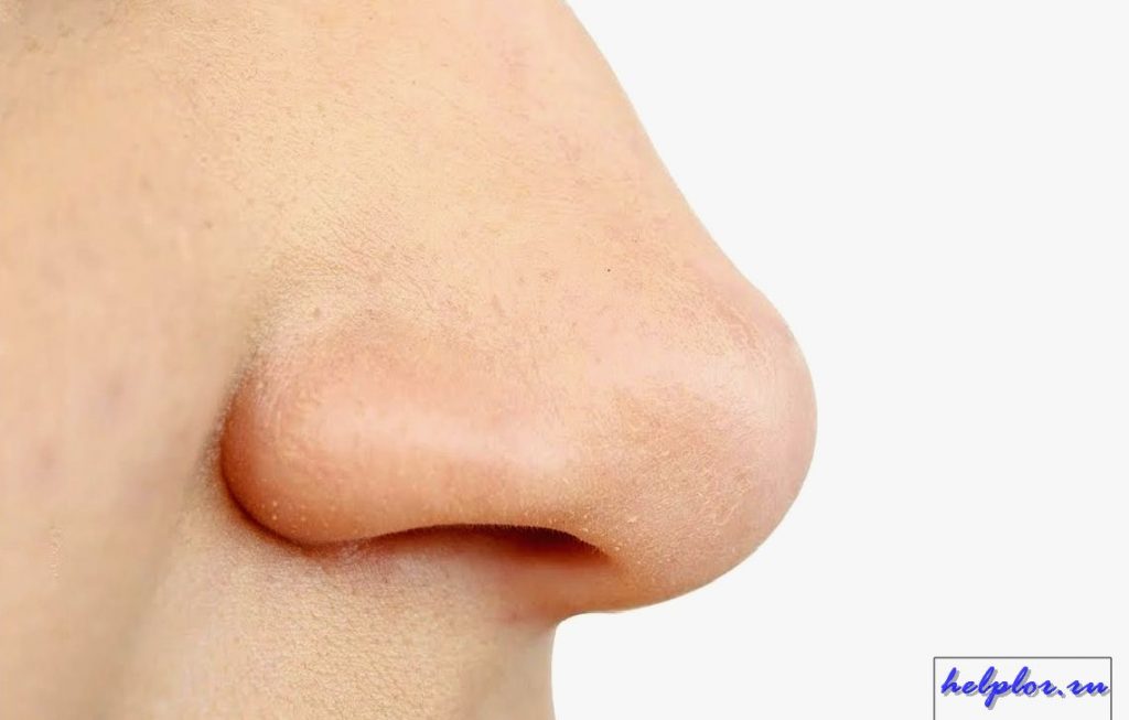 запах крови в носу